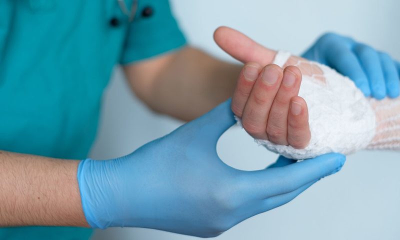 close up of doctor bandaging one hand Document for Workers' Compensation